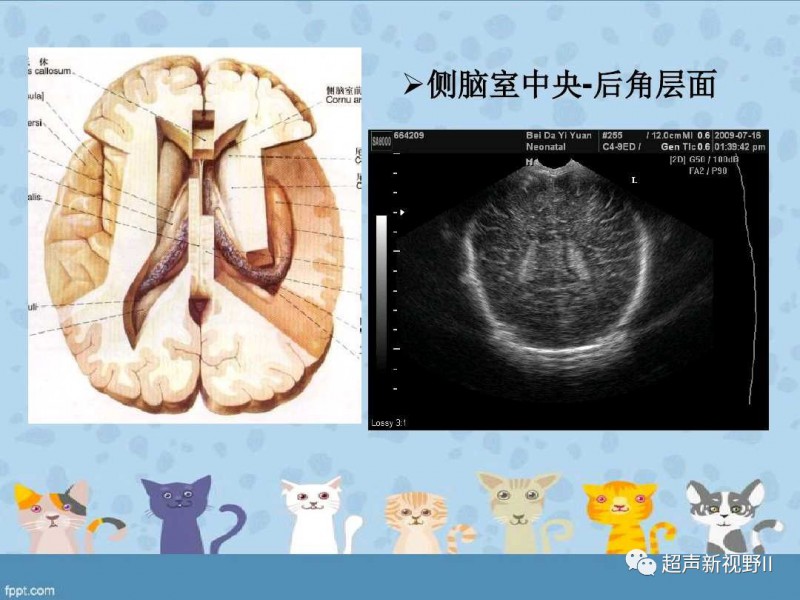 微信图片_20181128150712