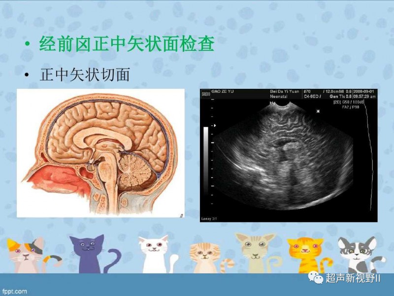 微信图片_20181128150716