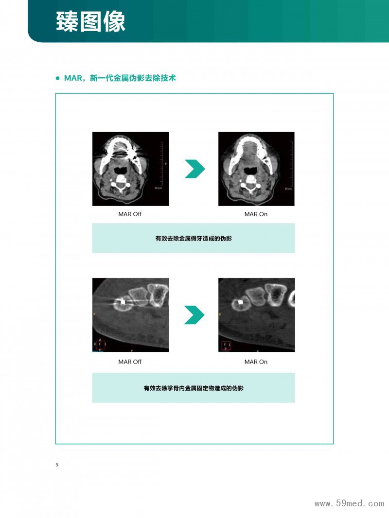 MX16彩页-6